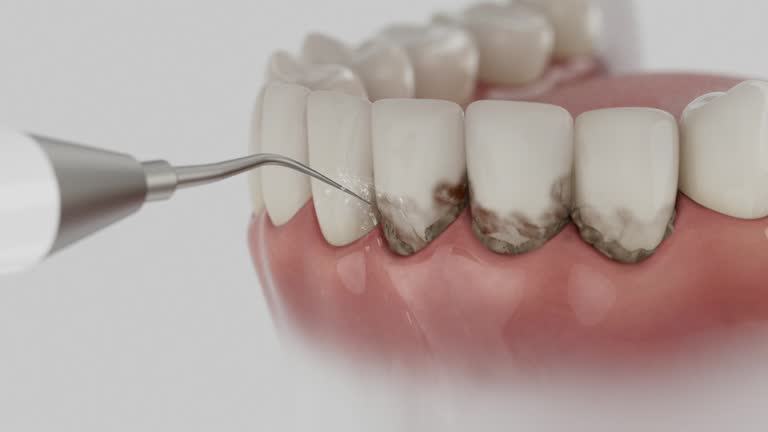 Trusted Tooth Extraction service in Seabrook, TX - Dentist Open Now